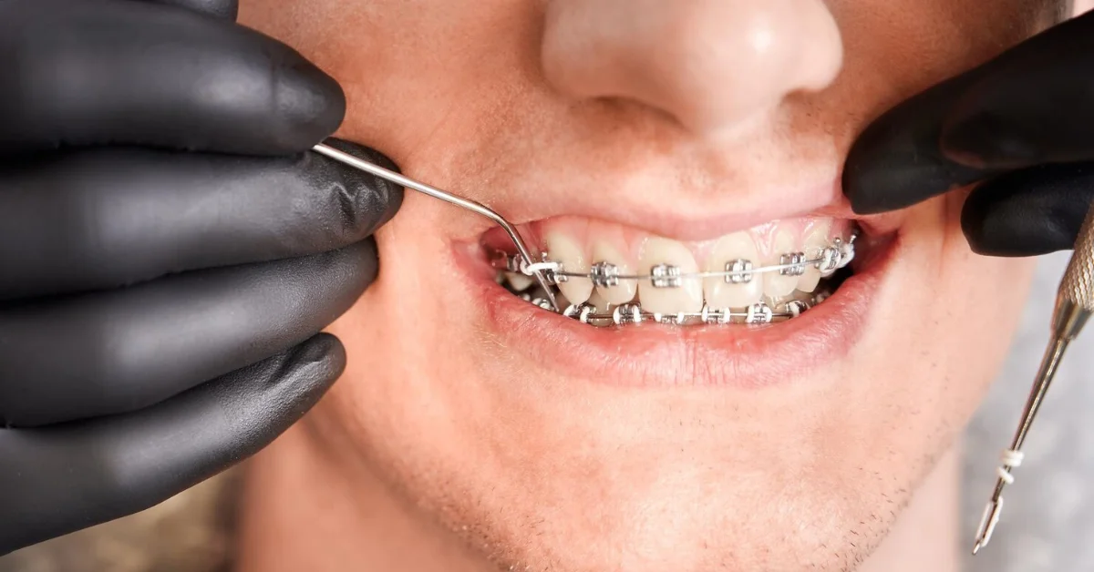 a man getting orthodontic treatment